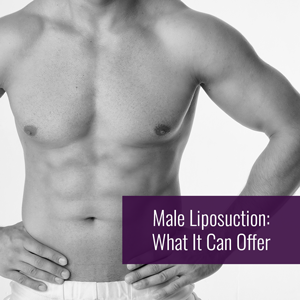 fit man displaying male liposuction