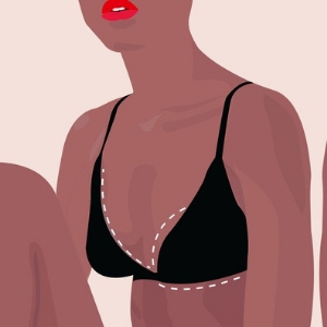 breast reduction graphic
