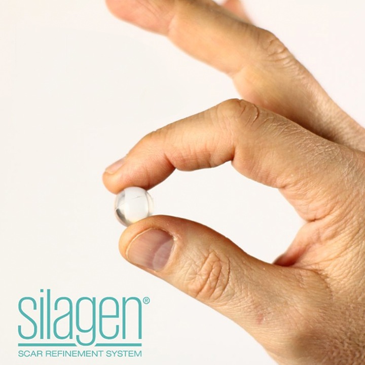 Silagen Silicone Umbilical Sphere Houston and The Woodlands TX