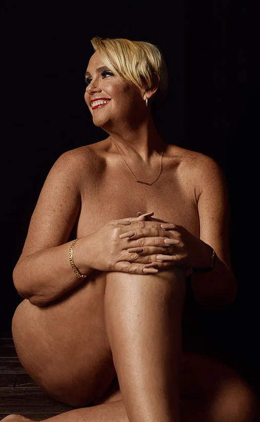 Body contouring patient