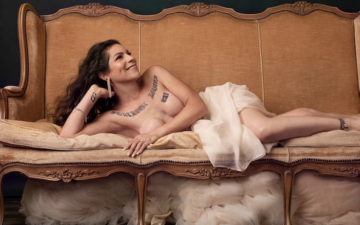 A gender affirming surgery patient