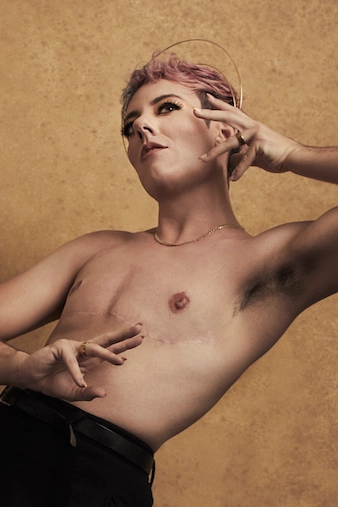 A Top Surgery Patient