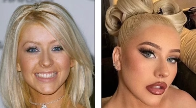 before and after photos of Christina Aguilera's face