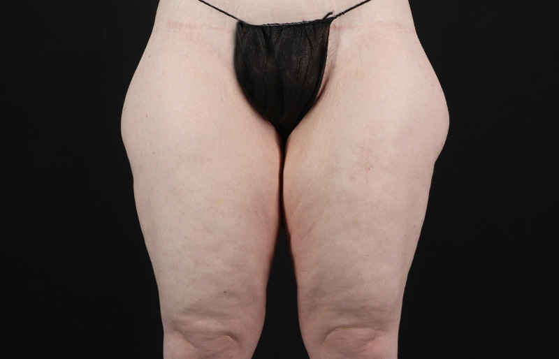 bna image
